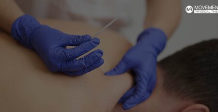 Discover the Benefits of Dry Needling at Movement Redefined